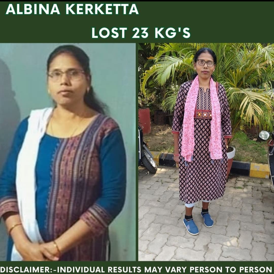 Albina